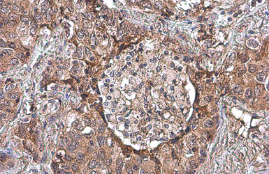 Anti-Uteroglobin antibody used in IHC (Paraffin sections) (IHC-P). GTX130640