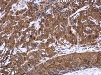 Anti-TES antibody used in IHC (Paraffin sections) (IHC-P). GTX130661