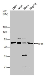 Anti-MUT antibody used in Western Blot (WB). GTX130666