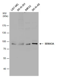 Anti-Semaphorin 3A antibody used in Western Blot (WB). GTX130671