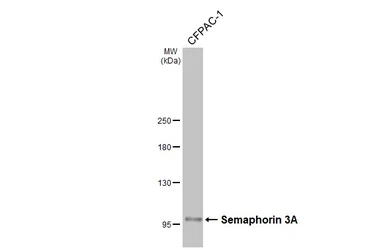 Anti-Semaphorin 3A antibody used in Western Blot (WB). GTX130671