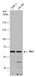 Anti-ME2 antibody used in Western Blot (WB). GTX130673