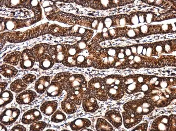 Anti-LYRIC antibody used in IHC (Paraffin sections) (IHC-P). GTX130679