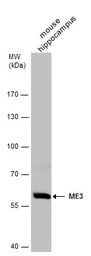 Anti-ME3 antibody used in Western Blot (WB). GTX130689
