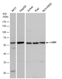 Anti-LKB1 antibody used in Western Blot (WB). GTX130697