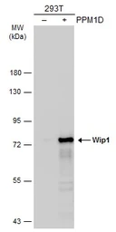 Anti-Wip1 antibody used in Western Blot (WB). GTX130700