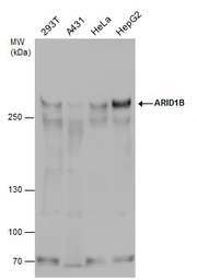 Anti-ARID1B antibody used in Western Blot (WB). GTX130708