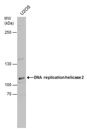 Anti-DNA replication helicase 2 antibody used in Western Blot (WB). GTX130713