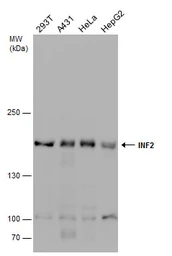 Anti-INF2 antibody used in Western Blot (WB). GTX130714