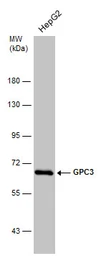 Anti-Glypican-3 antibody used in Western Blot (WB). GTX130732