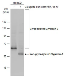 Anti-Glypican-3 antibody used in Western Blot (WB). GTX130732