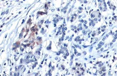 Anti-Glypican-3 antibody used in IHC (Paraffin sections) (IHC-P). GTX130732