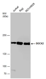 Anti-DOCK2 antibody used in Western Blot (WB). GTX130734