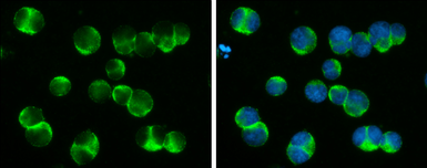 Anti-DOCK2 antibody used in Immunocytochemistry/ Immunofluorescence (ICC/IF). GTX130734