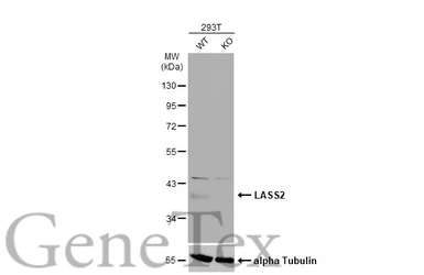 Anti-LASS2 antibody used in Western Blot (WB). GTX130744