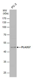 Anti-PLA2G7 antibody used in Western Blot (WB). GTX130757