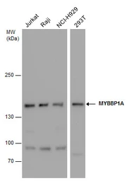 Anti-MYBBP1A antibody used in Western Blot (WB). GTX130760