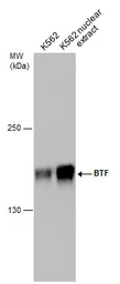 Anti-BTF antibody used in Western Blot (WB). GTX130772