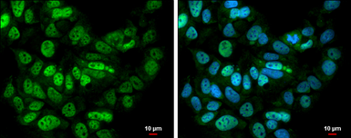 Anti-BTF antibody used in Immunocytochemistry/ Immunofluorescence (ICC/IF). GTX130772