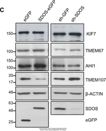 Anti-KIF7 antibody used in Western Blot (WB). GTX130782