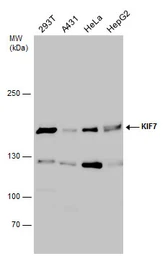 Anti-KIF7 antibody used in Western Blot (WB). GTX130782