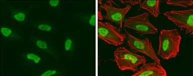 Anti-SNF2H antibody used in Immunocytochemistry/ Immunofluorescence (ICC/IF). GTX130794