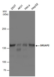 Anti-SRGAP2 antibody used in Western Blot (WB). GTX130797