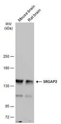Anti-SRGAP2 antibody used in Western Blot (WB). GTX130797