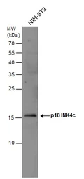 Anti-p18 INK4c antibody used in Western Blot (WB). GTX130798