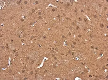 Anti-DIAPH3 antibody used in IHC (Paraffin sections) (IHC-P). GTX130803