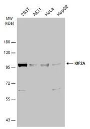Anti-KIF2A antibody used in Western Blot (WB). GTX130808