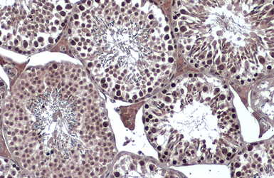 Anti-VRK2 antibody used in IHC (Paraffin sections) (IHC-P). GTX130826