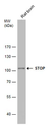 Anti-STOP antibody used in Western Blot (WB). GTX130830