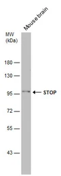 Anti-STOP antibody used in Western Blot (WB). GTX130830