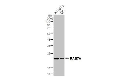 Anti-RAB7A antibody used in Western Blot (WB). GTX130847