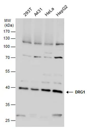 Anti-DRG1 antibody used in Western Blot (WB). GTX130850