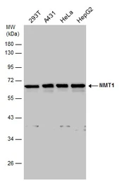 Anti-NMT1 antibody used in Western Blot (WB). GTX130852