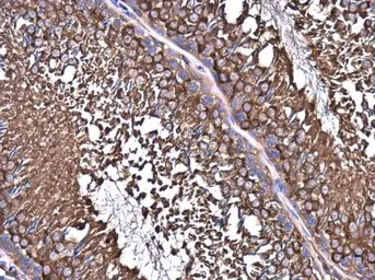Anti-NMT1 antibody used in IHC (Paraffin sections) (IHC-P). GTX130852
