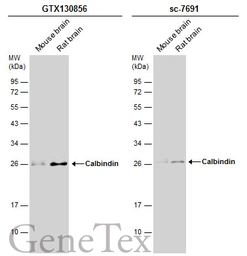 Anti-Calbindin antibody used in Western Blot (WB). GTX130856