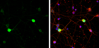 Anti-Calbindin antibody used in Immunocytochemistry/ Immunofluorescence (ICC/IF). GTX130856