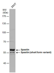 Anti-Spastin antibody used in Western Blot (WB). GTX130877
