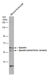 Anti-Spastin antibody used in Western Blot (WB). GTX130877