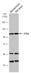 Anti-PYK2 antibody used in Western Blot (WB). GTX130887