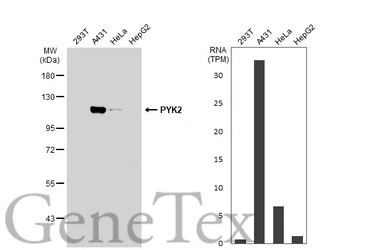 Anti-PYK2 antibody used in Western Blot (WB). GTX130887