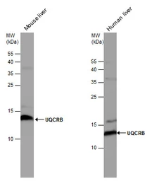 Anti-UQCRB antibody used in Western Blot (WB). GTX130895