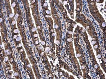 Anti-UQCRB antibody used in IHC (Paraffin sections) (IHC-P). GTX130895