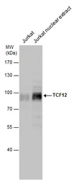 Anti-TCF12 antibody used in Western Blot (WB). GTX130901