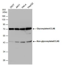 Anti-CLN5 antibody used in Western Blot (WB). GTX130920