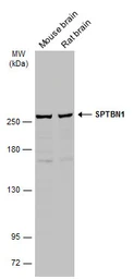 Anti-SPTBN1 antibody used in Western Blot (WB). GTX130935