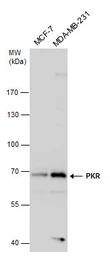 Anti-PKR antibody used in Western Blot (WB). GTX130941